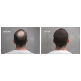 Samson Labs Keratin Boost hair thickening fibres dark brown before and after results back of head
