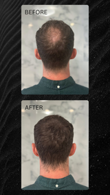 Keratin Boost