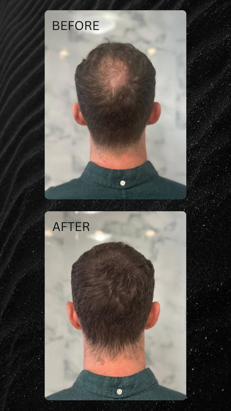 Keratin Boost