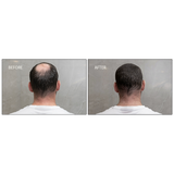 Samson Labs Cover Clay waterproof hair loss solutions before and after results rear view