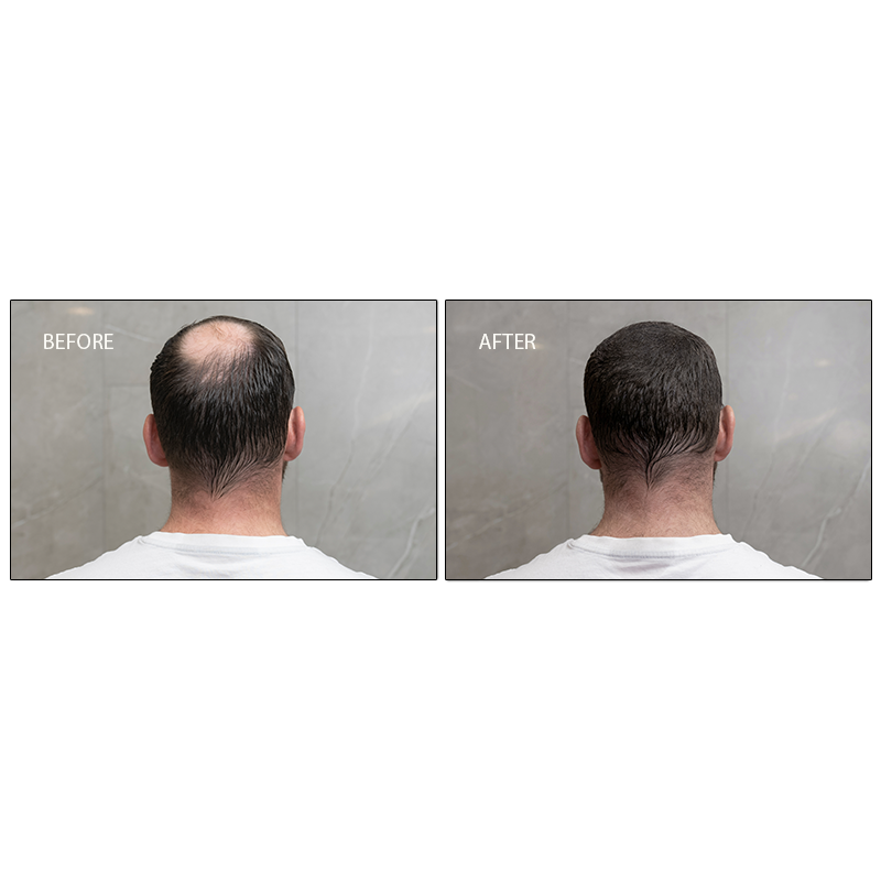 Samson Labs Cover Clay waterproof hair loss solutions before and after results rear view