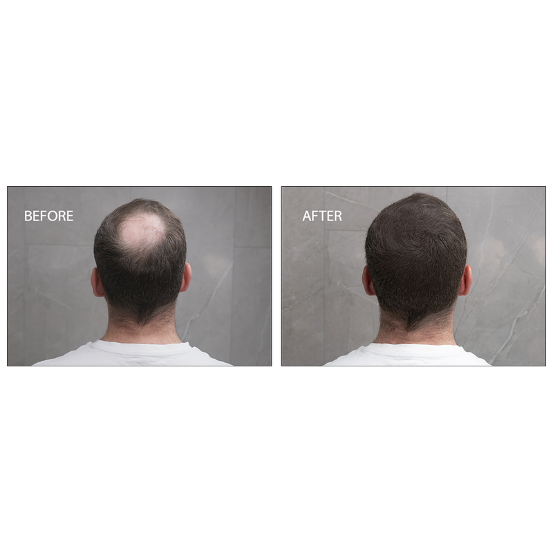 Samson Labs Keratin Boost hair thickening fibres dark brown before and after results back of head